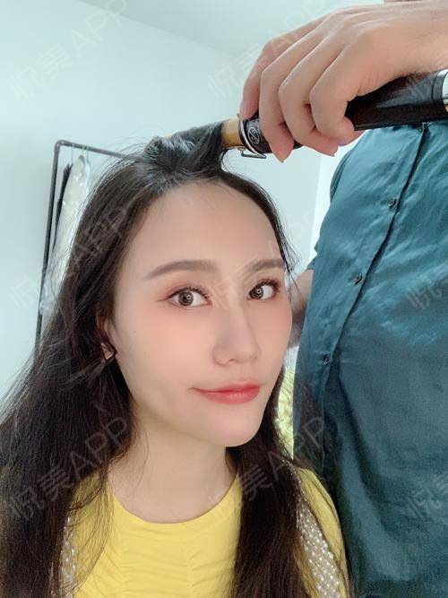 悦美整形新品发布日 自体脂肪填充与专业化妆造型的完美邂逅